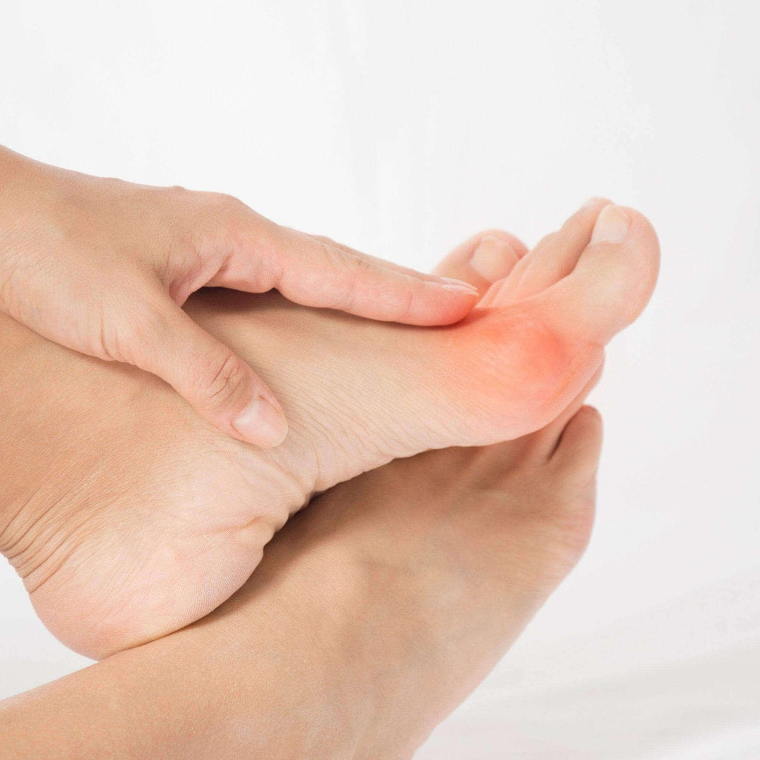 Bunions Care & Protectors - The Foot Care Shop