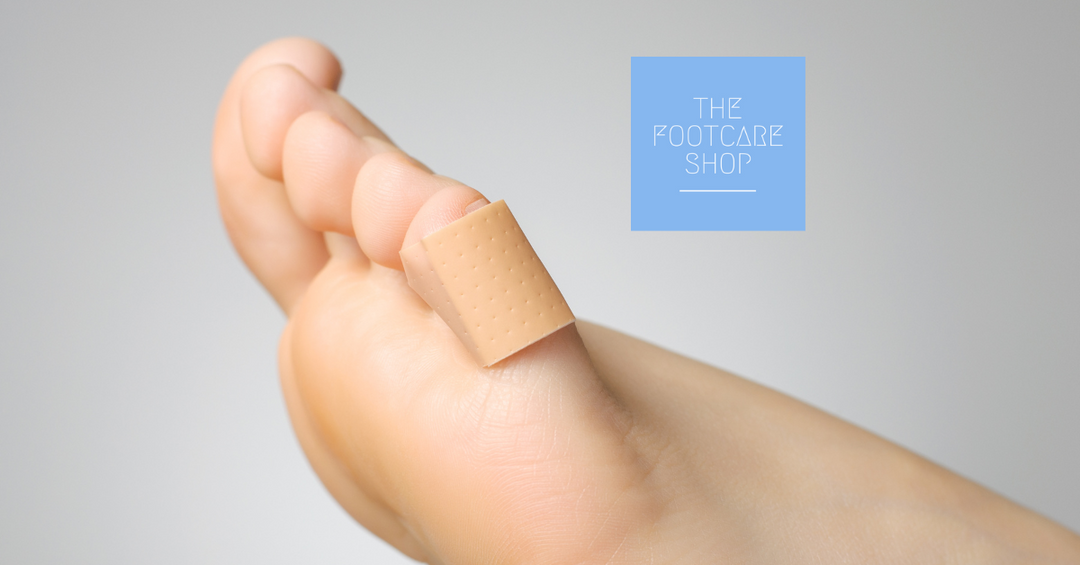 Corns And Calluses - What are the causes and how to treat them..