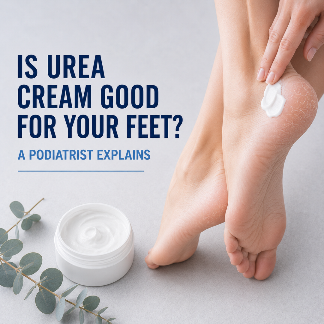 Urea cream being applied to a dry cracked heel for foot care