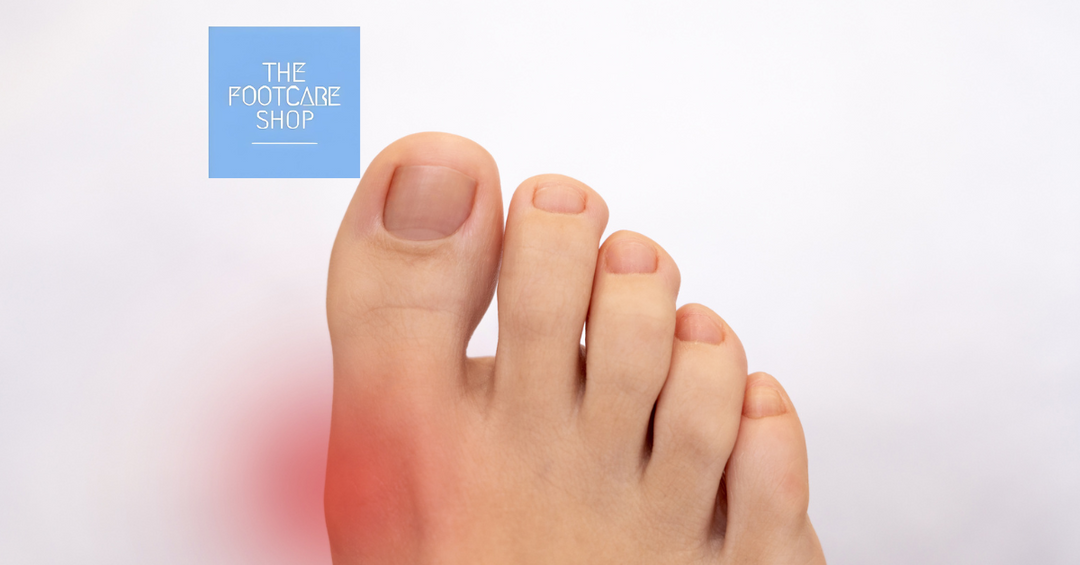 Hallux Ridgidus - Causes and Treatment.