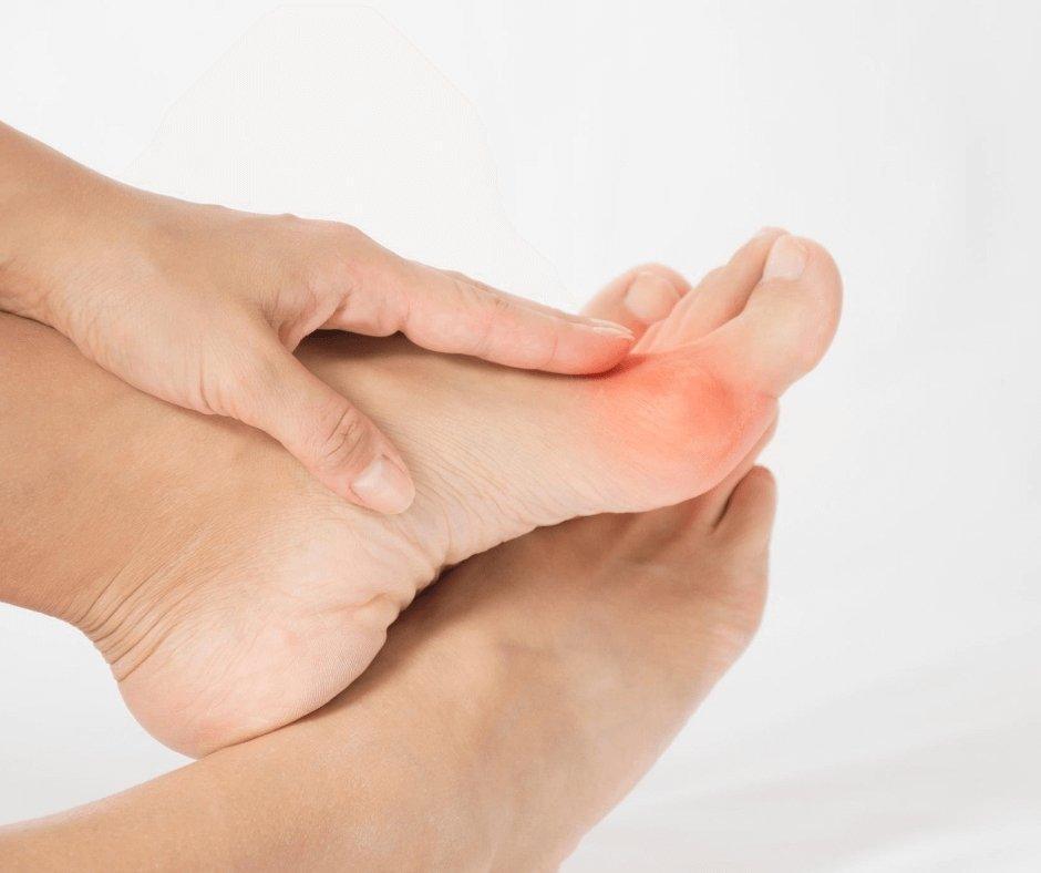 Bunions, Clawed & Hammer Toes, Corns & Callous - The Foot Care Shop
