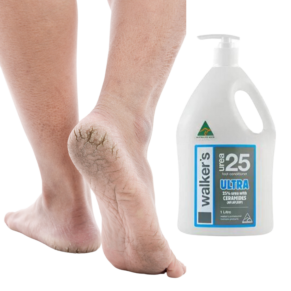 Walkers Urea 25 Ultra Foot Cream - 1 Litre.