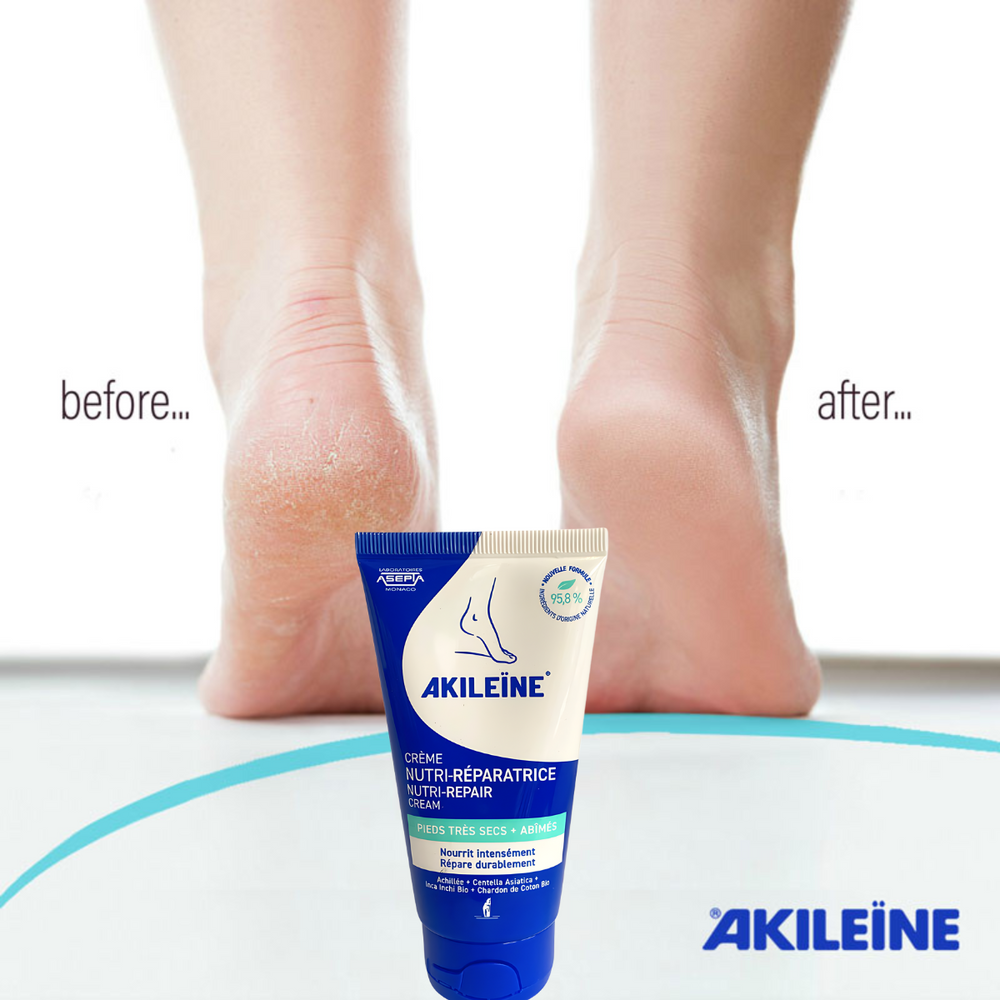 Akileine Blue Foot Cream.