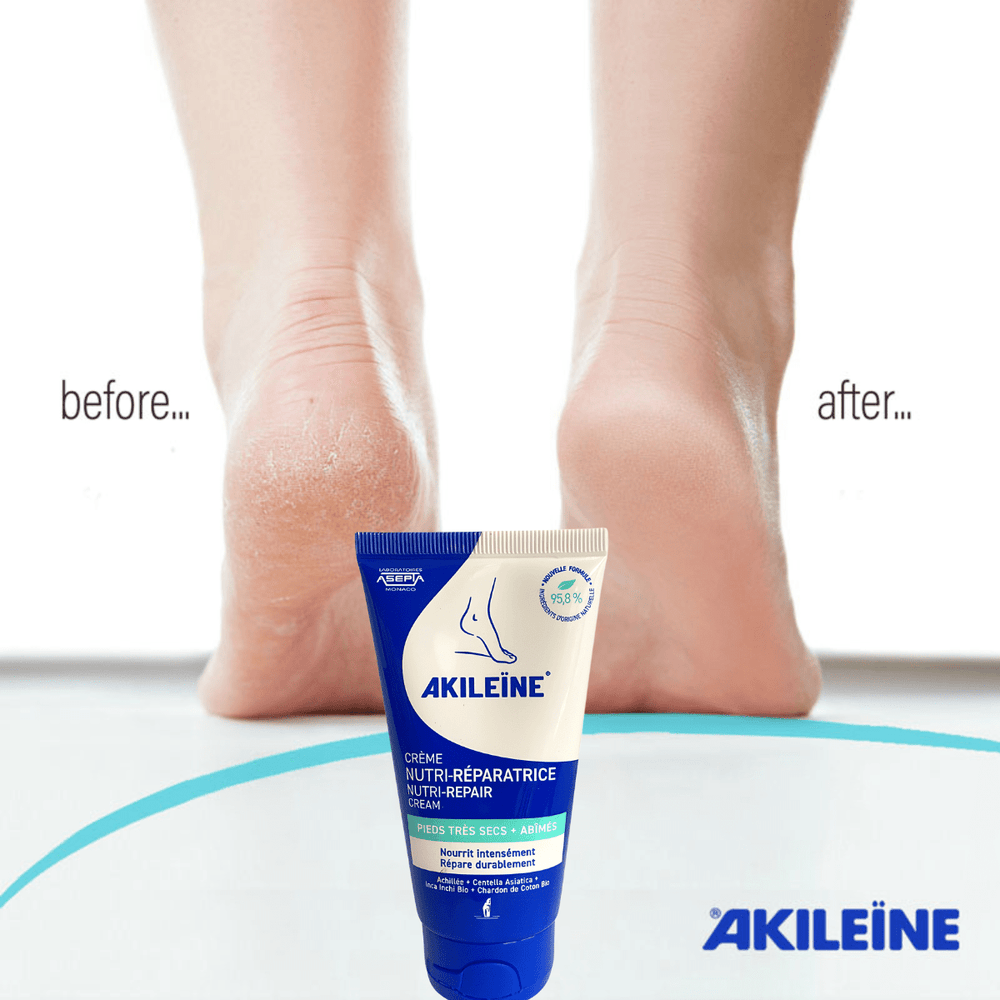 Akileine Foot Cream Akileine Blue Foot Cream