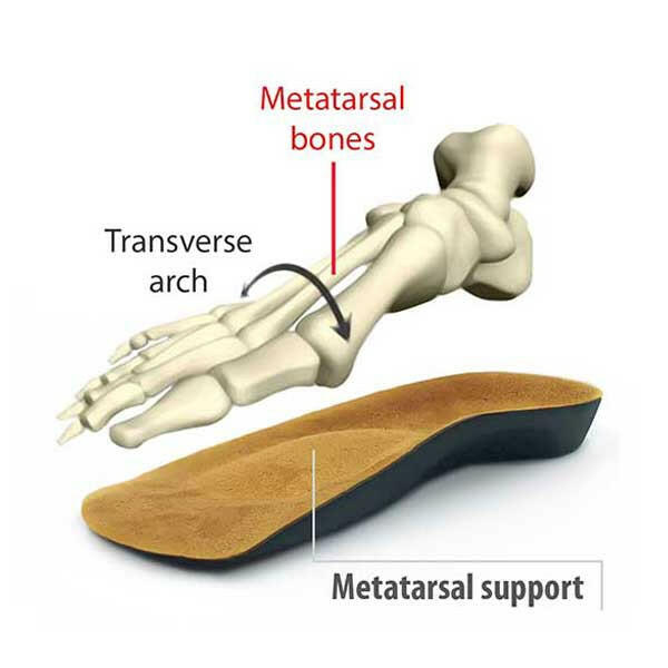 Footlogics Insoles & Inserts Footlogics Metatarsalgia 3/4 Insoles