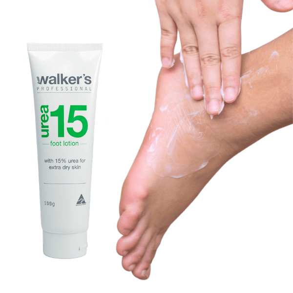 aloe vera for plantar fasciitis Walkers Urea 15 Cream 100gm