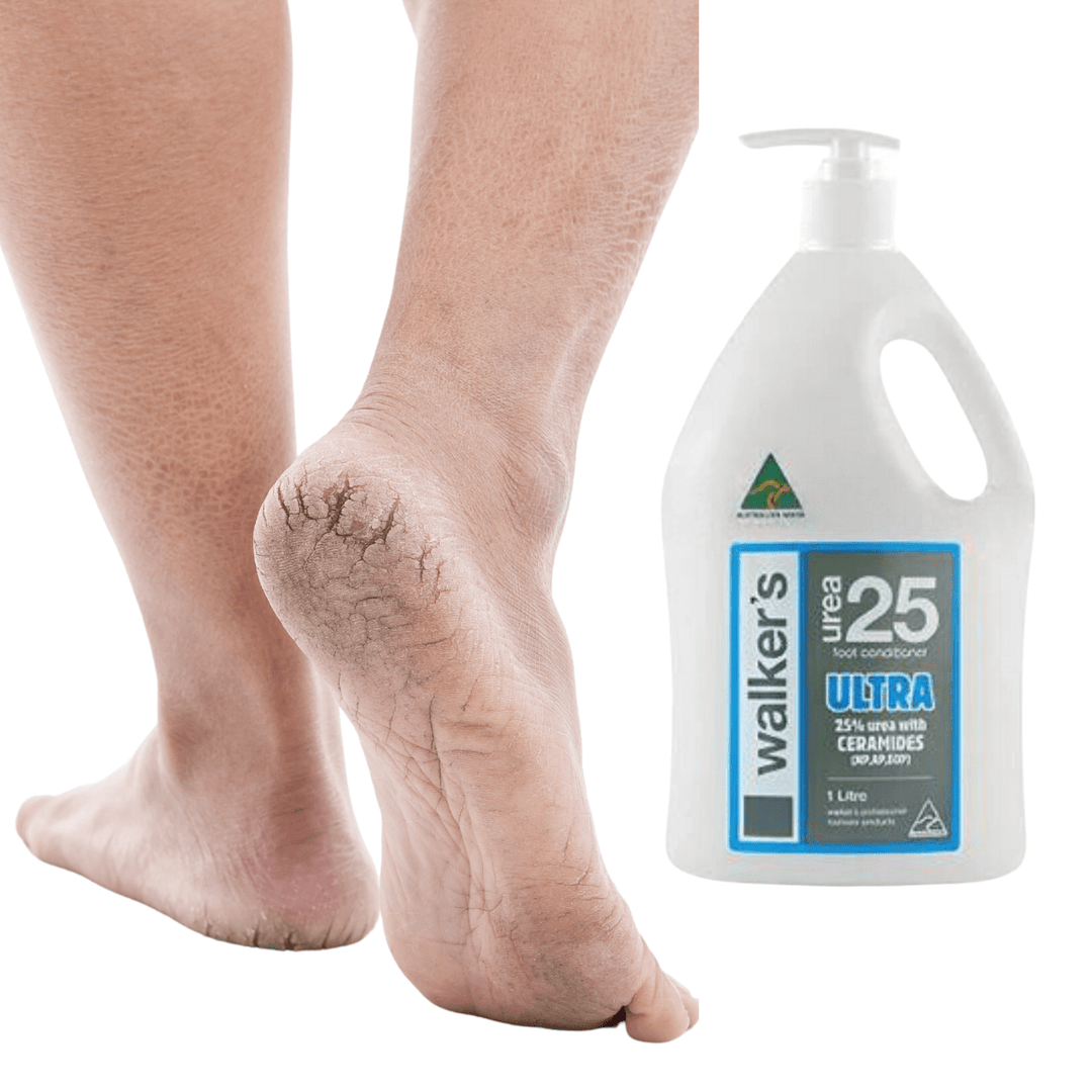 Walkers Urea Foot Cream Walkers Urea 25 Ultra Foot Cream - 1 Litre